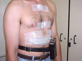 Holter 24 horas preco exame